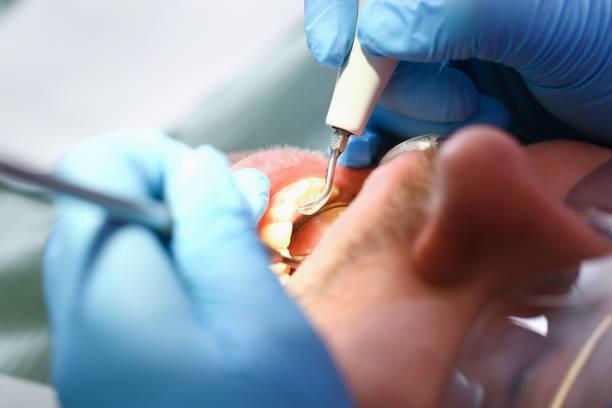 Best Emergency Dental Services Near Me  in Cleora, OK