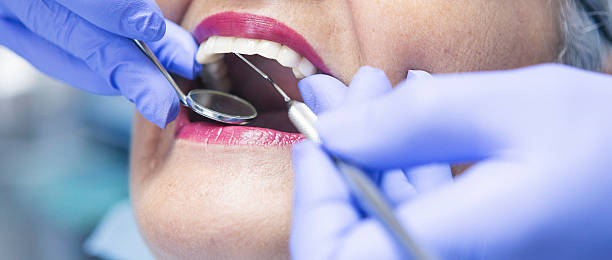 Best Teeth Whitening  in Cleora, OK