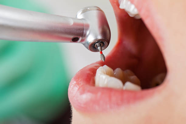 Best Knocked-Out Tooth Emergency  in Cleora, OK
